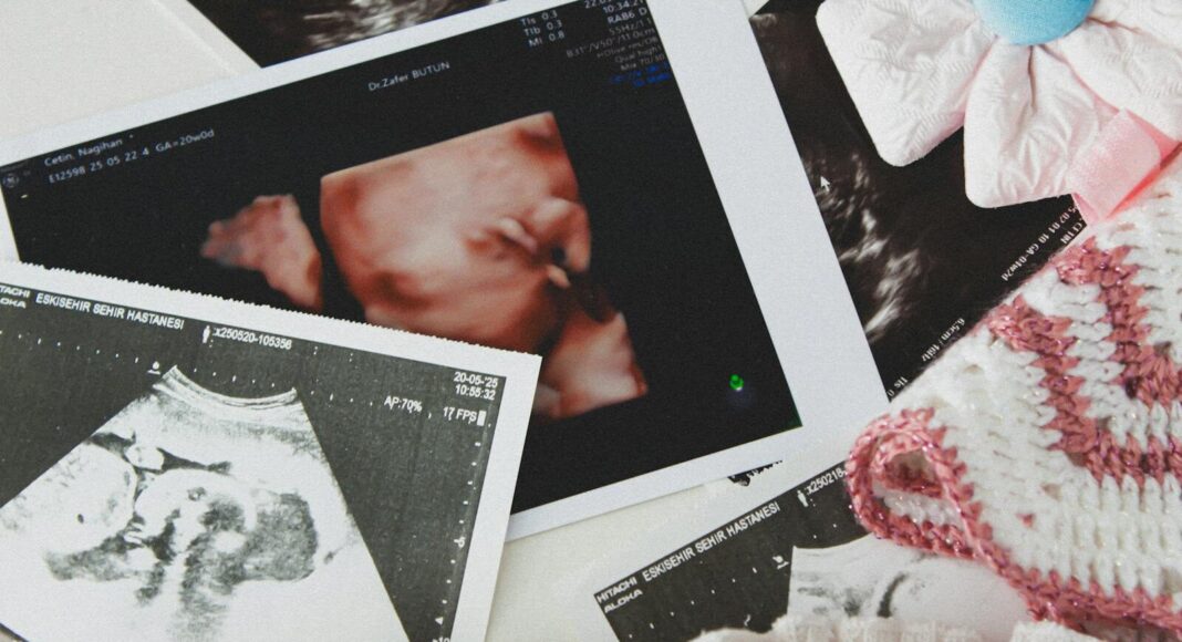 Photo by Emine Gizem Ultrasound images surrounded by baby clothing and accessories.