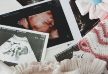 Northern Ireland introduces paid miscarriage leave as workplace rights expand Ultrasound images surrounded by baby clothing and accessories.