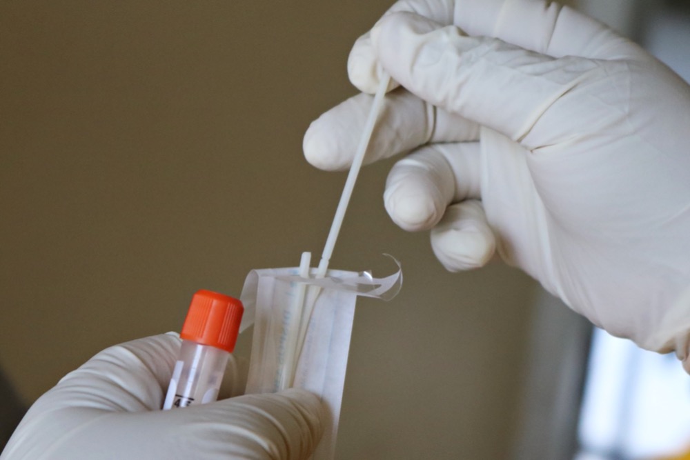 Close-up of gloved hands holding a swab and specimen container, preparing for a COVID-19 medical test.